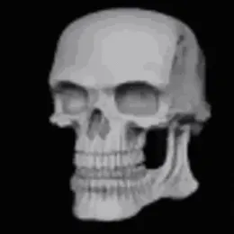 Skull: A Reincarnated Skeleton from Our World