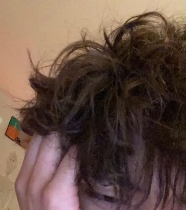 HP Next Gen — Albus Potter